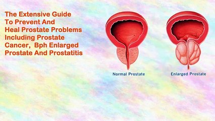 Healthy Prostate