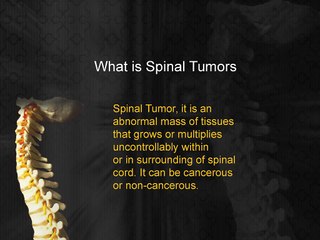 Spinal Tumors Treatment in India