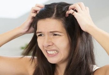 8 Cara Alami Menghilangkan Ketombe