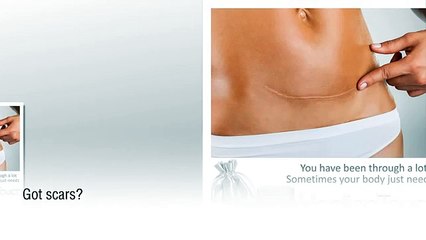 Effective Scar Solution from The Healing Touch