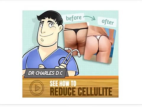 Cellulite Factor System Real Cellulite Factor System Awesome Tips [LEAKED]