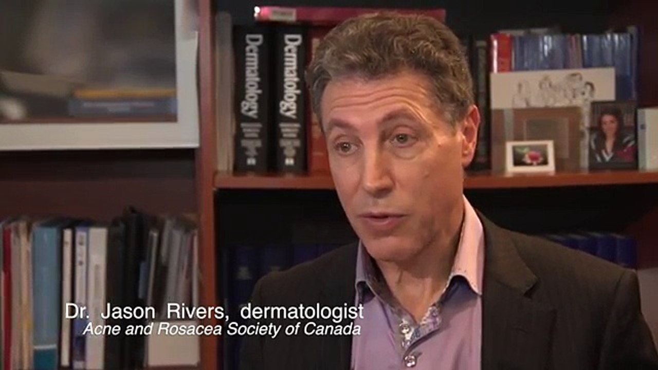 Rosacea  awareness survey