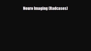 [PDF Download] Neuro Imaging (Radcases) [PDF] Full Ebook