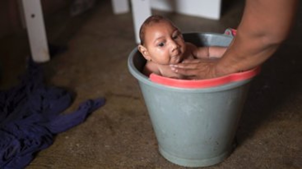 Dünyayı Sarsan Zika Virüsü Nedir, Nasıl Bulaşır?