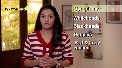 Download Video: Home Remedies for Acne Treatment - Skin Care