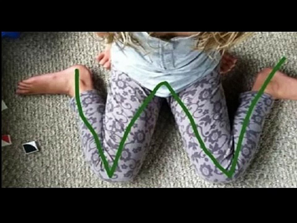 If You See Your Children With In This Position Immediately Stop Them!
