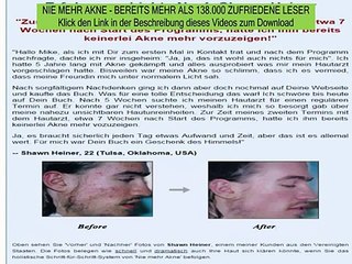 plötzliche akne ursachen - akne für immer bekämpfen - nie mehr akne video