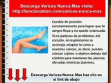 Descarga Varices Nunca Mas Pdf Libro