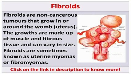 See now fibroids miracle scam