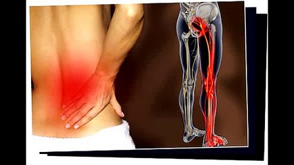 Sciatica SOS Program + Bonuses Review - Sciatica SOS reviews