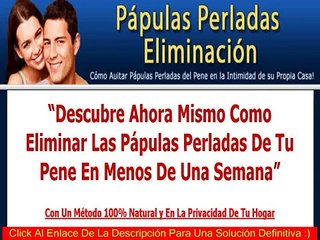 Papulas Perladas Eliminacion