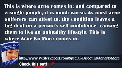 Acne No More The Secrets To Curing Your Acne Holistically - Acne No More Product