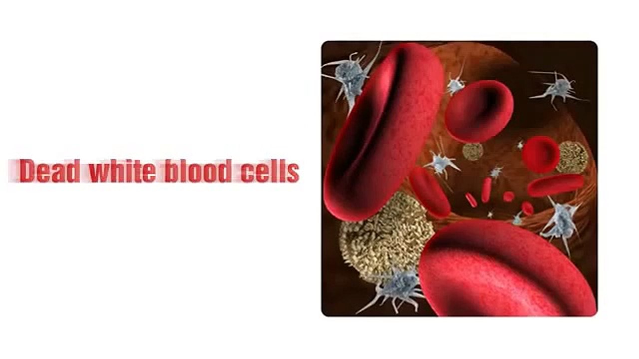 Acne No More Part 2 - The secrets to Curing Your Acne Holistically