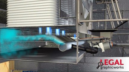 Animation Elbow Injury and Surgery for Litigation Support