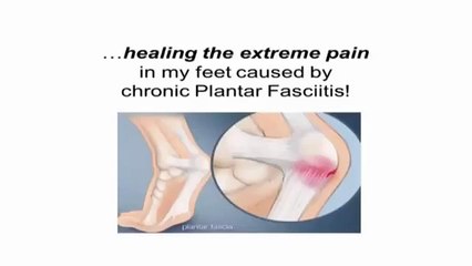 ➽Plantar Fasciitis Relief in 7 Days Review