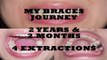Adult Braces Journey Before and After Time Lapse Photos