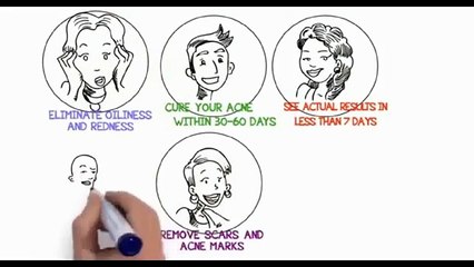 Benzoyl peroxide acne treatment with acne no more