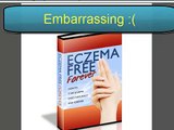 Eczema Free Forever Review INSIDE LOOK! Shocking truth revealed!