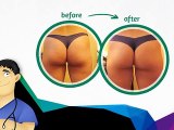 Cellulite Factor - Cellulite Factor Review - Cellulite Factor Review