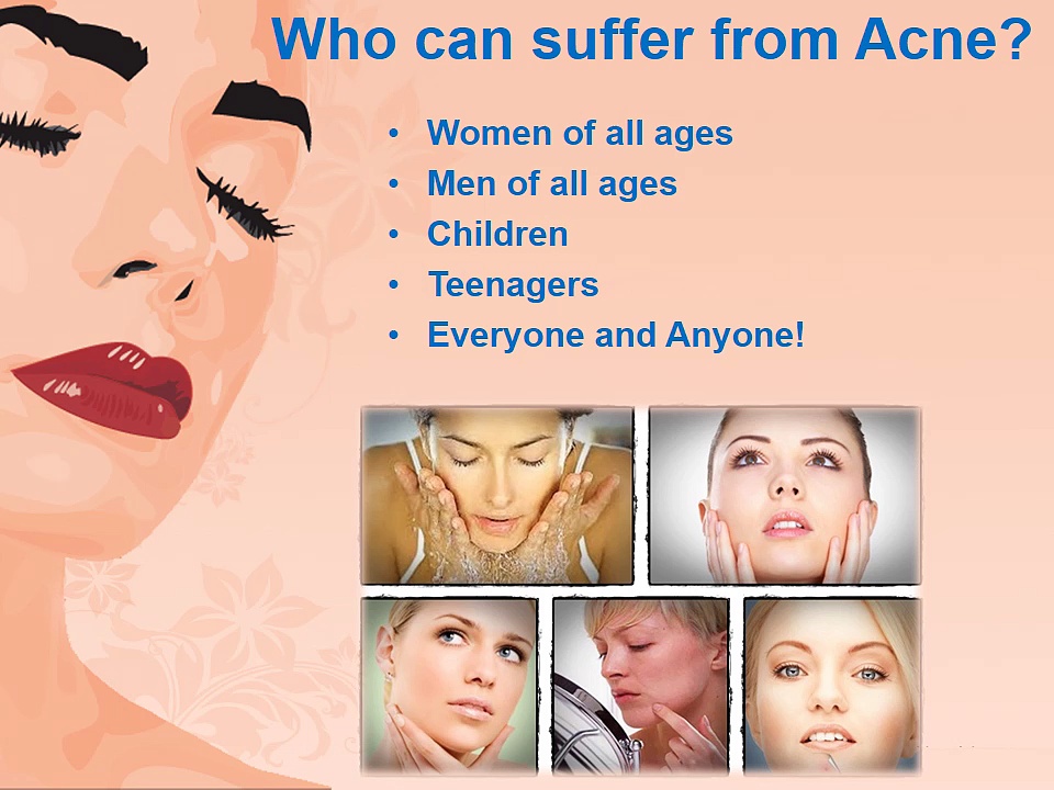 How To Get Rid Of Oily Skin