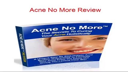 Acne No More Review [SHOCKING] - My Real and Honest Acne No More Review!