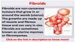 See now fibroids miracle book