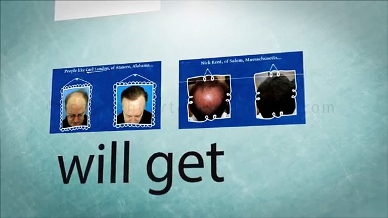 Hair Loss Protocol Program Review