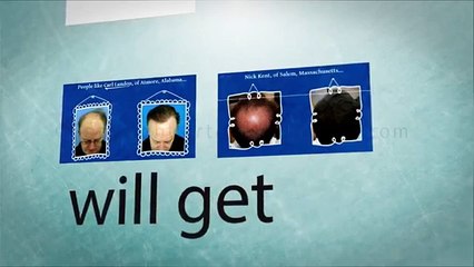 Hair Loss Protocol Program Review