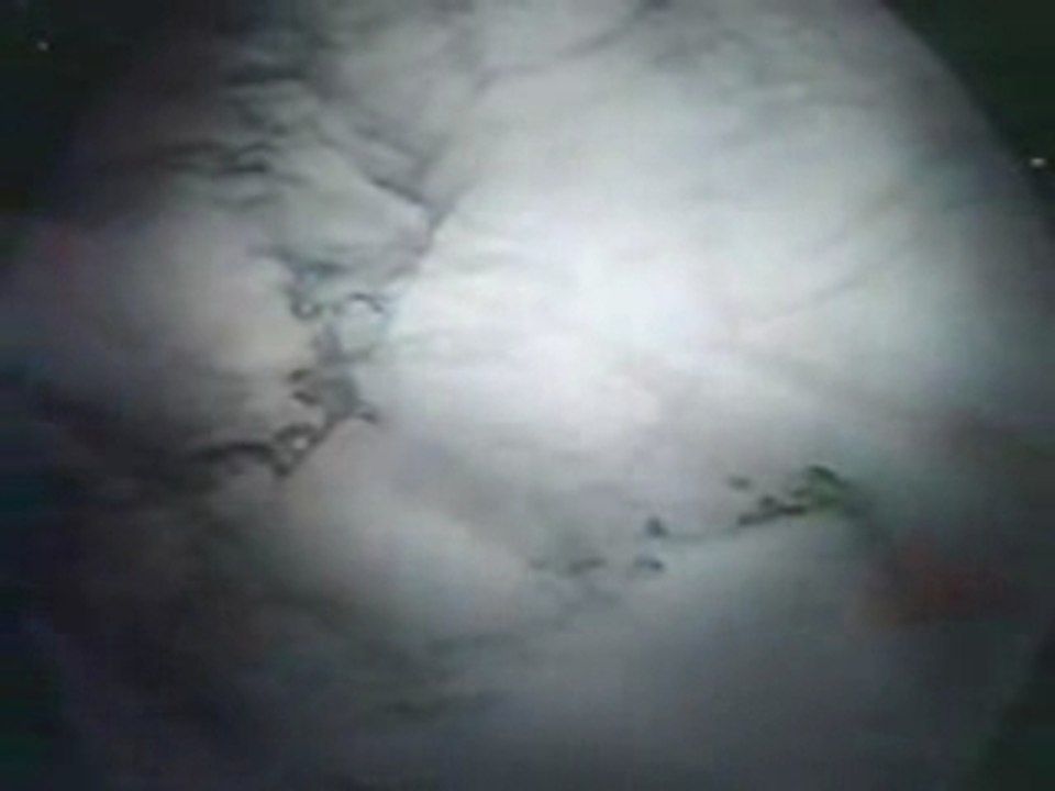 Generique - Mortdelacinq