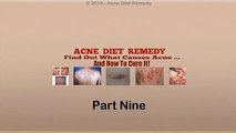 Acne Diet Remedy (Part 9) - A Look Inside Acne No More System by Mike Walden