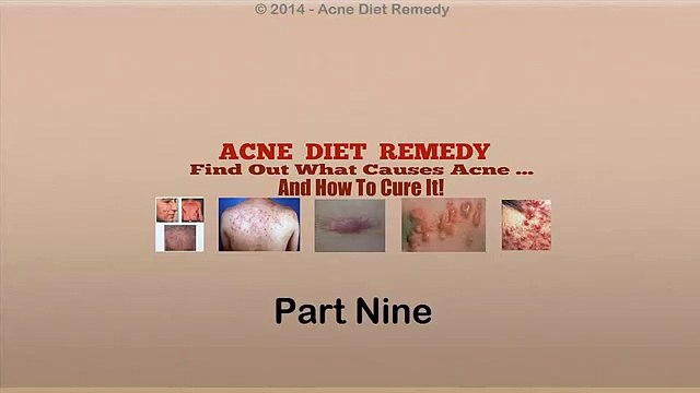 Acne Diet Remedy (Part 9) - A Look Inside Acne No More System by Mike Walden