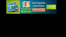 Banish My Bumps Review