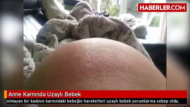 Anne Karnındaki Bebeğin Hareketi Şaşırttı