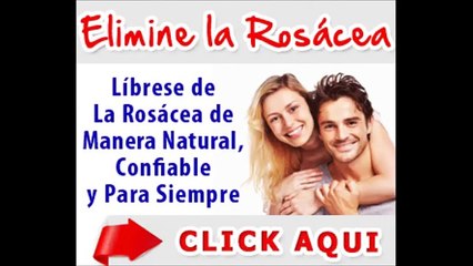 Acne Rosácea.Cura para la Rosacea.Rosacea Tratamiento