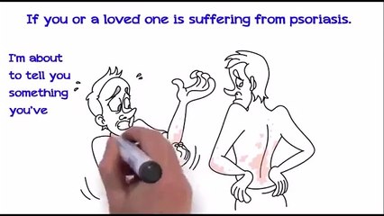 Psoriasis Revolution FREE VID (For more see Description Below)