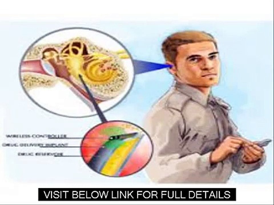 Cure Tinnitus Holistically   Tinnitus Miracle Review Guide