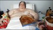 Worlds fattest man, Keith Martin dead at 44, after successful weight loss surgery