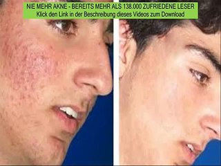 plötzlich akne schwanger - akne ursache bekämpfen - nie mehr akne test