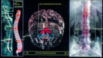 Helix s1 e10