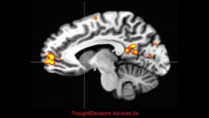 Elevate your thoughts - Thought elevators elevate your thoughts - Elevate your life!