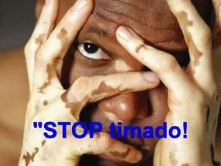 Milagro para el Vitiligo