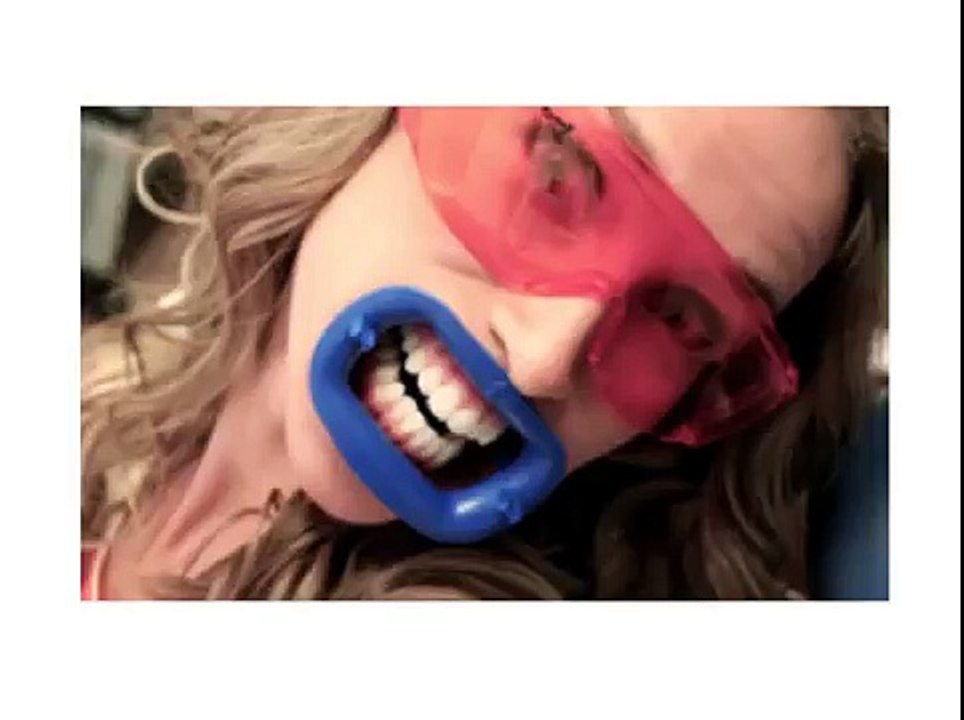 2015 Review TEETH WHITENING 4 YOU