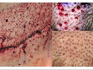 HAIR LOSS BLACK BOOK 2015 Review
