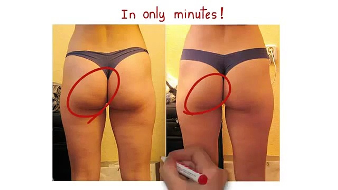 Cellulite Factor
