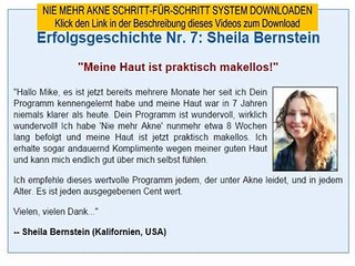 akne natürlich - nie mehr akne von mike walden