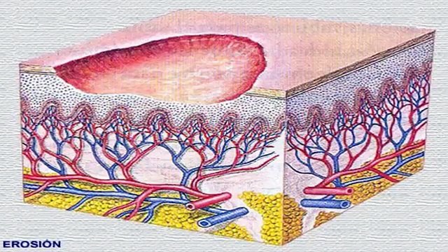 Celulitis Nunca Mas ® La Cura Natural por Mercedes Vila (Descargar)