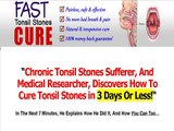 Fast Tonsil Stones Cure Review & Discount