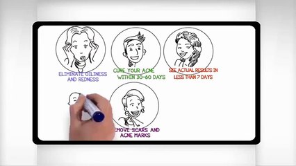 Acne No More tm  Top CB Acne Cure   Original Bestseller Since 2003