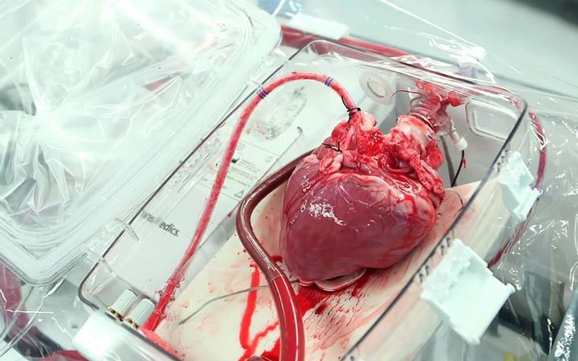 This device can bring dead hearts back to life.