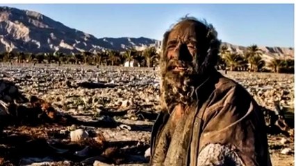 61 Yıldır Yıkanmayan Adam! Görünce Şaşıracaksınız - DailyTube